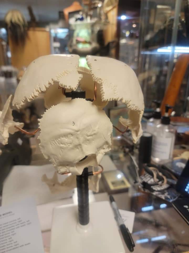 Beauchene Human Exploded skull cast replica - Image 2