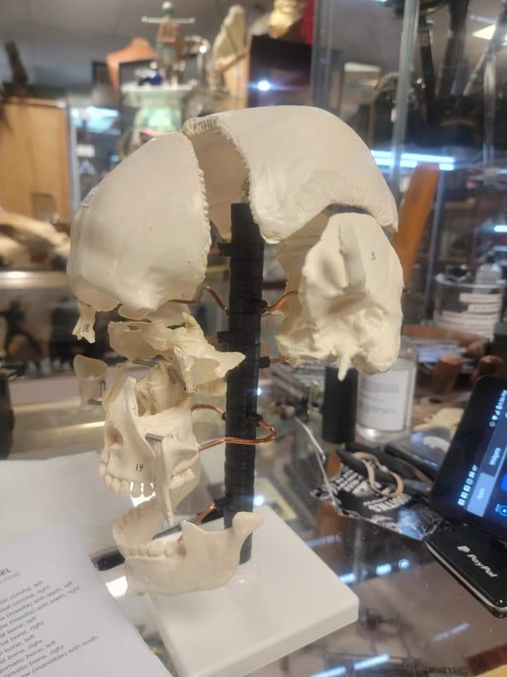 Beauchene Human Exploded skull cast replica - Image 3