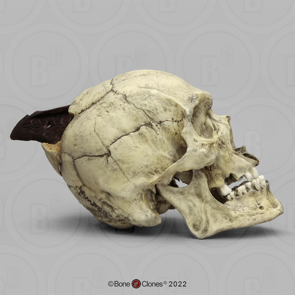 Spanish Conquistador Human Skull with Broad Ax Trauma Human skull Ax cast replica Bone Clones (Updated 12/25) - Image 14