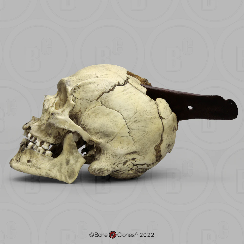 Spanish Conquistador Human Skull with Broad Ax Trauma Human skull Ax cast replica Bone Clones (Updated 12/25) - Image 15